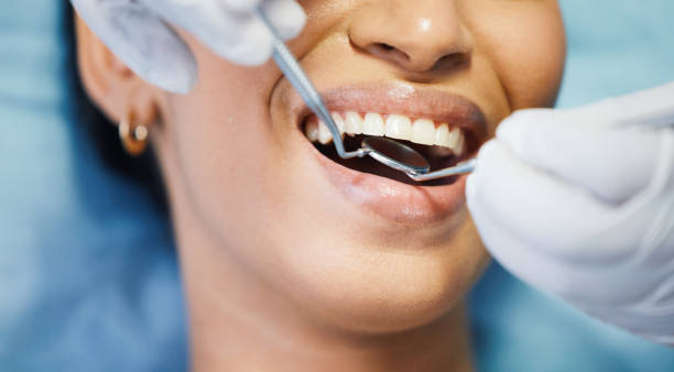 Best Emergency Gum Treatment in Lake Kerr, FL