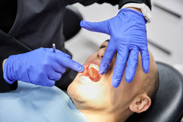 Best Emergency Treatment for Dental Infections or Abscesses in Lake Kerr, FL