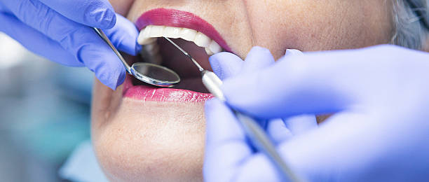 Best Emergency Wisdom Teeth Removal in Lake Kerr, FL
